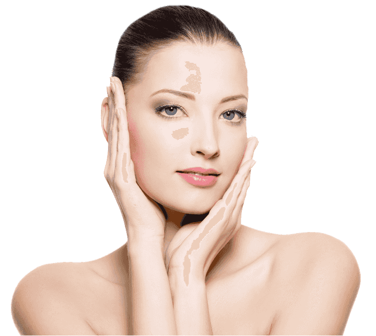 Microneedling